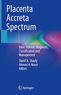 Placenta Accreta Spectrum -  - E-Book