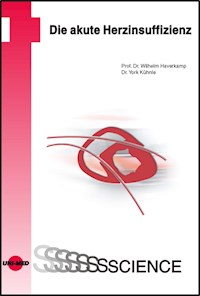Die akute Herzinsuffizienz - Wilhelm Haverkamp - E-Book