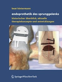 Endoprothetik des Sprunggelenks - Beat Hintermann - E-Book
