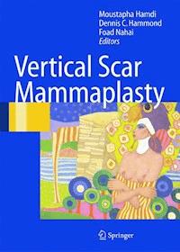Vertical Scar Mammaplasty -  - E-Book