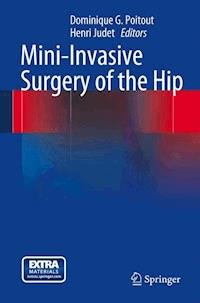 Mini-Invasive Surgery of the Hip -  - E-Book