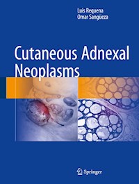 Cutaneous Adnexal Neoplasms - Luis Requena - E-Book