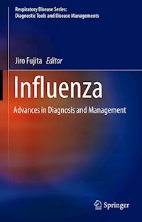 Influenza -  - E-Book