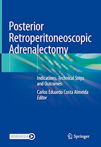 Posterior Retroperitoneoscopic Adrenalectomy -  - E-Book