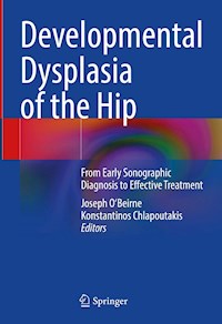 Developmental Dysplasia of the Hip - - E-Book