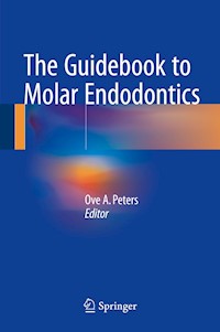 The Guidebook to Molar Endodontics - - E-Book