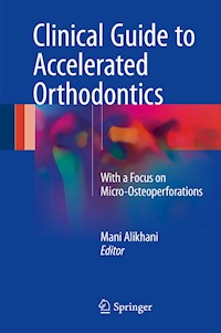 Clinical Guide to Accelerated Orthodontics -  - E-Book