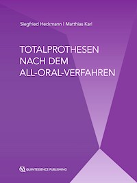 Totalprothesen nach dem All-Oral-Verfahren - Siegfried Heckmann - E-Book
