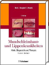 Mundschleimhaut und Lippenkrankheiten - Konrad Bork - E-Book