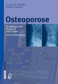 Osteoporose - Klaus M. Peters - E-Book