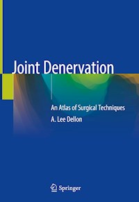 Joint Denervation - A. Lee Dellon - E-Book