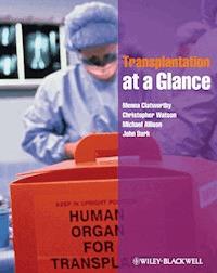 Transplantation at a Glance - Menna Clatworthy - E-Book