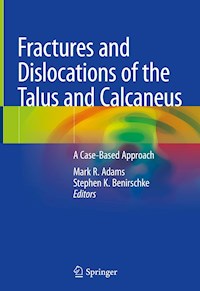 Fractures and Dislocations of the Talus and Calcaneus -  - E-Book