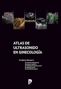 Atlas de ultrasonido en ginecología - Roberto Moncayo - E-Book