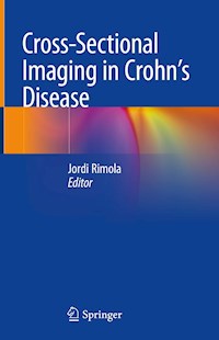 Cross-Sectional Imaging in Crohn’s Disease -  - E-Book