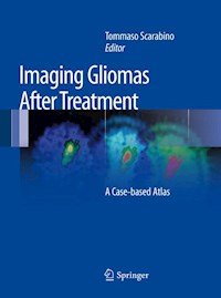 Imaging Gliomas After Treatment -  - E-Book
