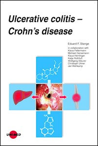 Ulcerative colitis - Crohn’s disease - Eduard F. Stange - E-Book