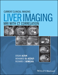 Liver Imaging -  - E-Book