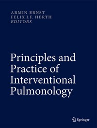 Principles and Practice of Interventional Pulmonology -  - E-Book