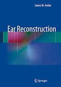 Ear Reconstruction - Juarez Avelar - E-Book