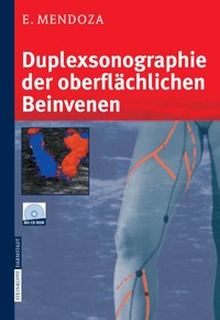 Duplexsonographie der oberflächlichen Beinvenen - Erika Mendoza - E-Book