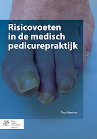 Risicovoeten in de medisch pedicurepraktijk - Toos Mennen - E-Book