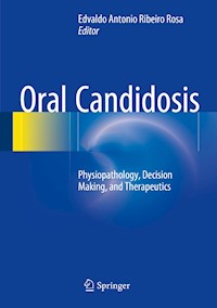 Oral Candidosis - - E-Book