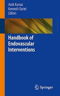 Handbook of Endovascular Interventions - - E-Book
