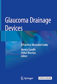 Glaucoma Drainage Devices -  - E-Book