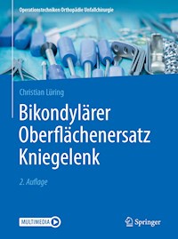 Bikondylärer Oberflächenersatz Kniegelenk - Christian Lüring - E-Book