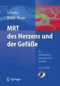 MRT des Herzens und der Gefäße - B. Schulte - E-Book