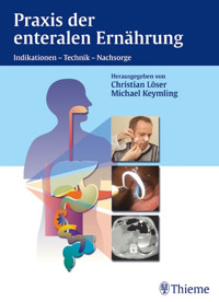 Praxis der enteralen Ernährung - Michael Keymling - E-Book