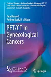 PET/CT in Gynecological Cancers -  - E-Book