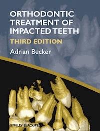 Orthodontic Treatment of Impacted Teeth - Adrian Becker - E-Book