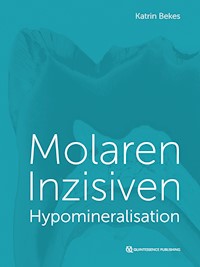 Molaren-Inzisiven-Hypomineralisation - Katrin Bekes - E-Book