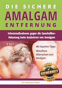 Die sichere Amalgam-Entfernung - Hartmut Sauer - E-Book