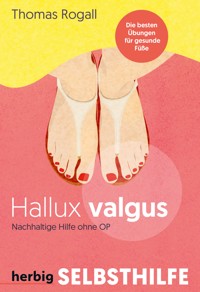 Hallux Valgus - Thomas Rogall - E-Book