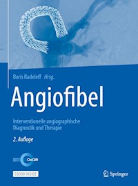 Angiofibel -  - E-Book