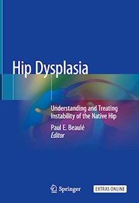Hip Dysplasia -  - E-Book